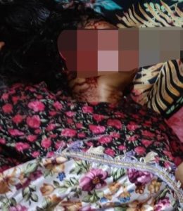 Suami Tega Habisi Istri, Kapolres Dompu Tindak Tegas